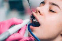 Mano de ortodoncista limpiando frenos dentales de niña en clínica . - foto de stock