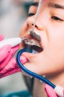 Mano de ortodoncista limpiando frenos dentales de niña en clínica . - foto de stock