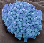 Micrographie électronique à balayage coloré des diatomées centrées sur l'eau douce frustules type d'algues . — Photo de stock
