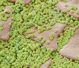 Micrographie électronique à balayage coloré brochosomes microscopiques complexes granules sécrétés par la cicadelle
. — Photo de stock