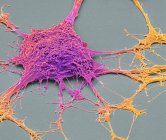 Scanning electron micrograph of PC12 neurone in culture. — Stock Photo