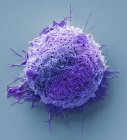 Micrógrafo electrónico de barrido coloreado de células cancerosas del colon humano . - foto de stock