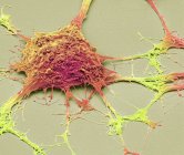 Micrografía electrónica de barrido de neurona PC12 en cultivo . - foto de stock