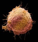 Кольорові мікрофотографія ракових клітин з людського товстої кишки. — стокове фото