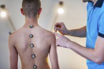 Fisioterapeuta colocando bolas de marcação reflexiva para análise de postura de menino adolescente . — Fotografia de Stock