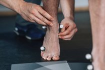 Фізичний терапевт розміщує відбиваючі кульки на ногах хлопчика для аналізу ходи . — стокове фото