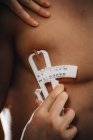 Médico que mide la grasa corporal en el pecho usando la prueba del espesor del pliegue cutáneo en atleta masculino . - foto de stock