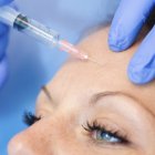Close-up of woman receiving botox treatment in forehead in clinic. — Stock Photo