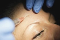 Close-up de mulher recebendo tratamento de botox na testa na clínica . — Fotografia de Stock