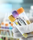Técnico segurando amostras de sangue, urina e química para testes clínicos em mão enluvada . — Fotografia de Stock