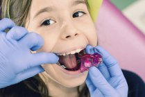 Руки стоматолога накладывают зубные скобки для маленькой девочки . — стоковое фото