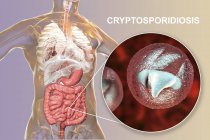 Cryptosporidium parvum parasite dans le corps humain causant cryptosporidiose, illustration numérique
. — Photo de stock