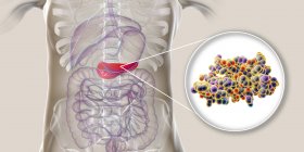 Páncreas en el cuerpo humano y vista de cerca de la molécula de insulina, ilustración digital . - foto de stock