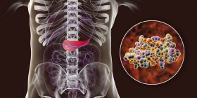 Páncreas en el cuerpo humano y vista de cerca de la molécula de insulina, ilustración digital . - foto de stock