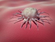 Раковые клетки, цепляющиеся за толстую кишку человека, концептуальная иллюстрация
. — стоковое фото