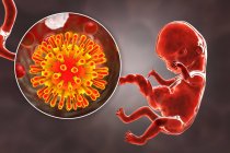 Transmission transplacentaire du VIH infectant un embryon humain de 8 semaines, illustration conceptuelle par ordinateur . — Photo de stock