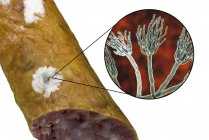 Embutido ahumado mohoso e ilustración del hongo microscópico Penicillium que causa deterioro de los alimentos y produce penicilina antibiótica
. - foto de stock