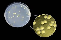Micrococcus luteus bacteria on surface of nutrient medium in Petri dish. — Stock Photo