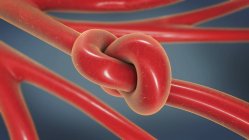 3d ilustración de nudo sanguíneo en vaso arterial . - foto de stock