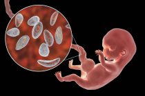 Transplacental transmission of Toxoplasma gondii parasites to human embryo, conceptual illustration. — Stock Photo