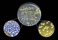 Cultivo bacteriano a partir de piel humana en placa Petri con medio nutritivo
. - foto de stock