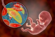 Трансплацентальна передача паразитів токсоплазми гонад до людського ембріона, концептуальна ілюстрація . — стокове фото