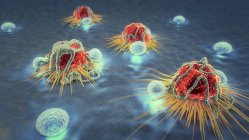 3D-Illustration von Lymphozyten, die Krebszellen im menschlichen Körper angreifen. — Stockfoto