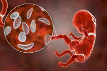 Трансплацентарная передача паразитов Toxoplasma gondii человеческому эмбриону, концептуальная иллюстрация . — стоковое фото