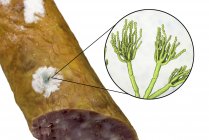 Embutido ahumado mohoso e ilustración del hongo microscópico Penicillium que causa deterioro de los alimentos y produce penicilina antibiótica . - foto de stock