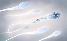 3d illustration of damaged spermatozoon in human sperm. — Stock Photo
