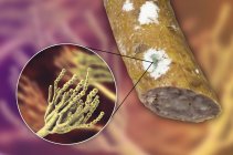 Verschimmelte Räucherwurst und Darstellung des mikroskopischen Pilzes Penicillium, der Lebensmittelverderb verursacht und Antibiotikum Penicillin produziert. — Stockfoto