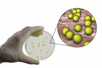 Kompositbild der Wissenschaftlerhand mit einer Kolonie von Mikrococcus luteus Bakterien im Nährmedium — Stockfoto