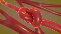 Ilustração 3d do nó sanguíneo no vaso arterial . — Fotografia de Stock