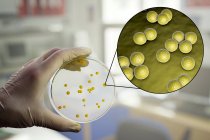 Composite image of scientist hand with colony of Micrococcus luteus bacteria in nutrient medium — Stock Photo