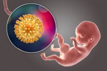 Transmissão transplacentária de HIV infectando embrião humano de 8 semanas, ilustração conceitual . — Fotografia de Stock