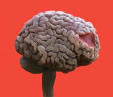 Пошкодження мозку людини, цифрова медична ілюстрація . — стокове фото