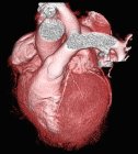 Здорове серце на чорному тлі, 3D комп'ютерна томографія сканування . — стокове фото