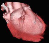 Gesundes Herz auf schwarzem Hintergrund, 3D-Computertomographie. — Stockfoto