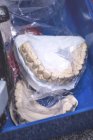 Зубной протез в пластиковом пакете, крупным планом . — стоковое фото