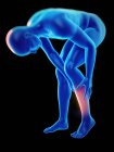 Silhouette umana con dolore alla gamba, illustrazione digitale . — Foto stock
