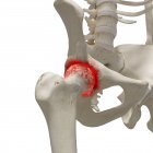 Ilustración digital realista que muestra artritis en la cadera humana . - foto de stock