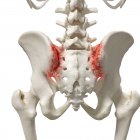 Ilustración digital realista que muestra artritis en sacro humano . - foto de stock