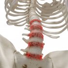 Ilustración digital realista que muestra artritis en la columna lumbar humana . - foto de stock