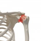 Illustration numérique réaliste montrant l'arthrite dans l'épaule humaine . — Photo de stock