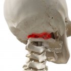Realistic digital illustration showing arthritis in human atlas vertebrae. — Stock Photo