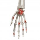 Ilustración digital realista que muestra artritis en la mano humana . - foto de stock