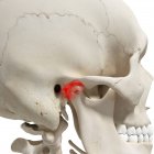 Ilustración digital realista que muestra artritis en la articulación mandibular humana . - foto de stock