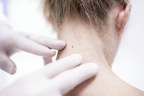 Doctor examining female patient mole on neck. — Stock Photo