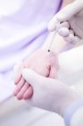 Dermatologo che inietta botox sul palmo della mano per trattare la sudorazione eccessiva, primo piano . — Foto stock