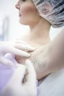 Dermatólogo inyectando botox en axilas femeninas para tratar la sudoración excesiva, primer plano . - foto de stock